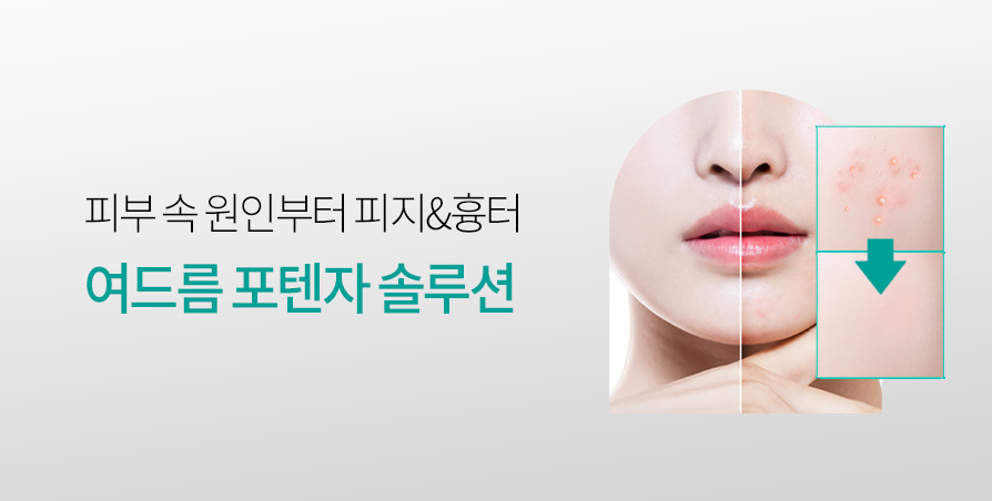 여드름 포텐자 Solution