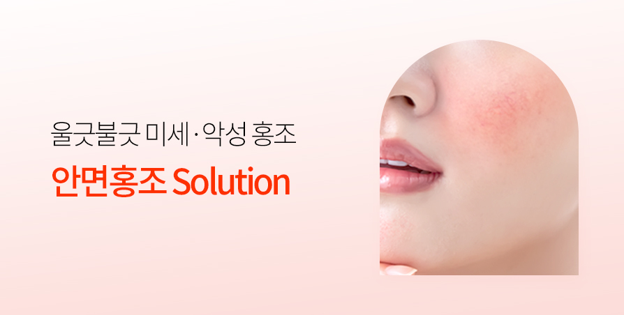 미세·악성 안면홍조 Solution