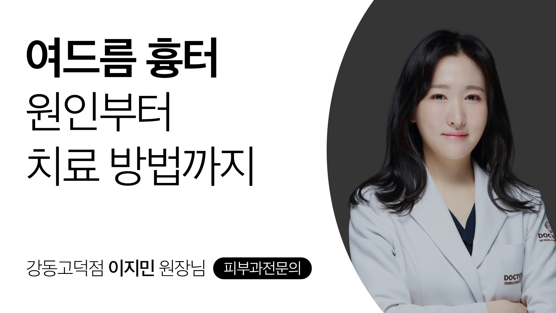 여드름 흉터, 원인부터 치료 방법까지