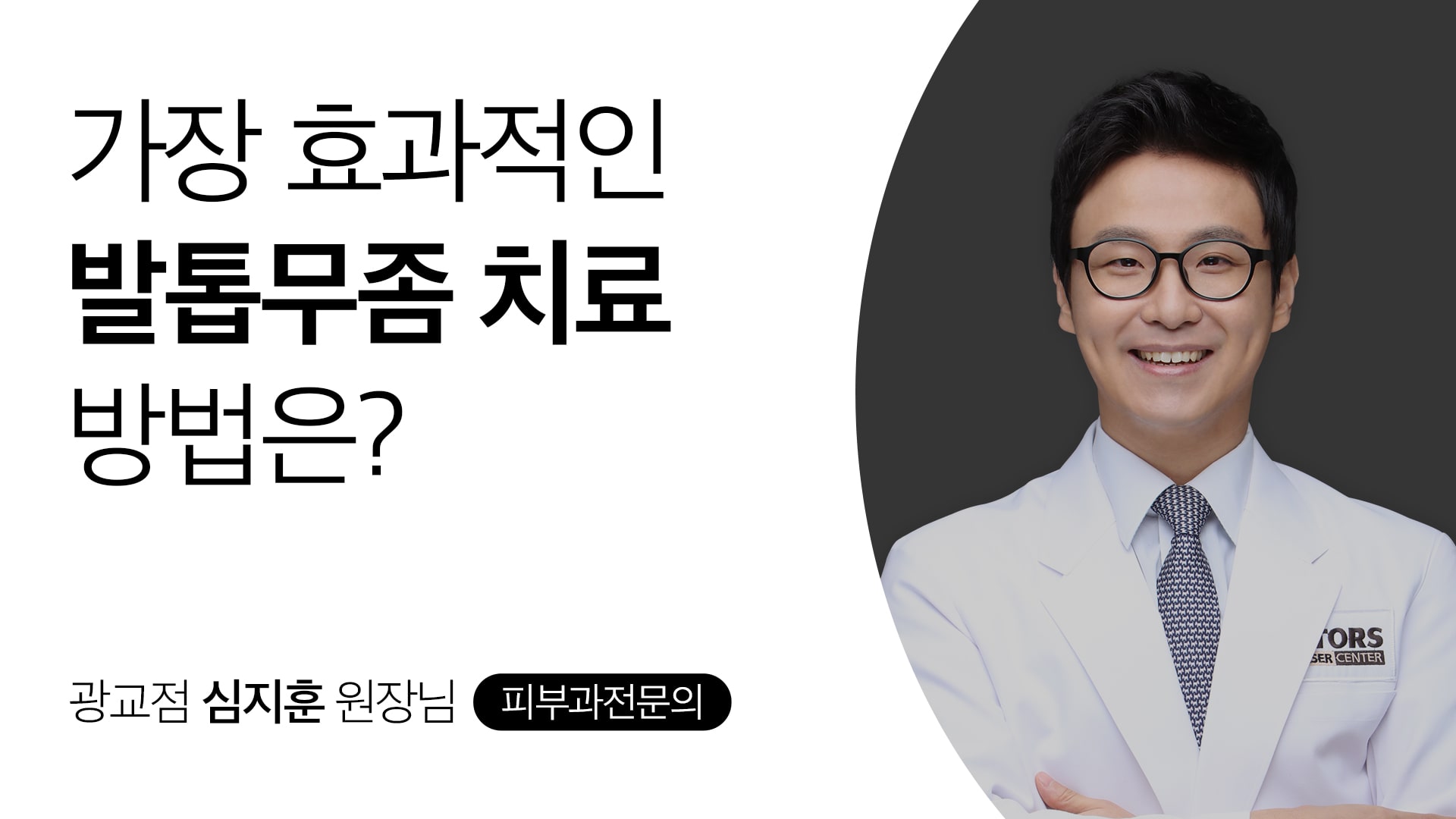 가장 효과적인 발톱무좀 치료 방법은?